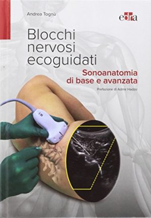 Blocchi nervosi ecoguidati Sonoanatomia di base avanzata