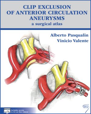 Clip exclusion of anterior circulation aneurysms: a surgical atlas