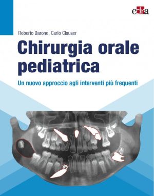 Chirurgia orale pediatrica Un nuovo approccio agli interventi più frequenti