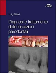 Diagnosi e trattamento delle forcazioni parodontali