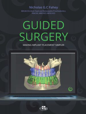 GUIDED SURGERY - Making implant placement simpler