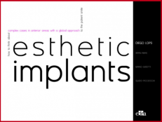 Esthetic Implants