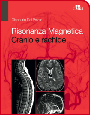 Risonanza Magnetica Cranio e rachide