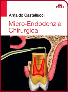 Micro-Endodonzia Chirurgica