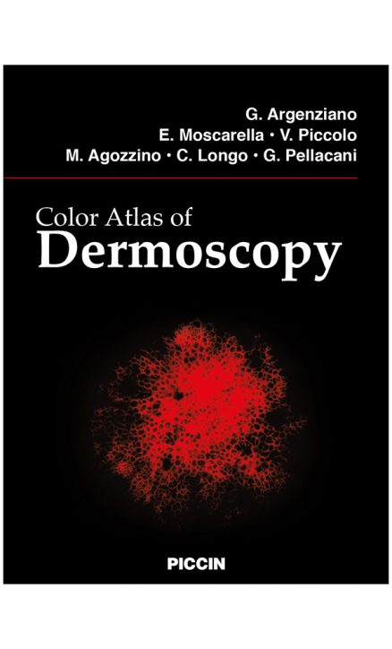Color Atlas of Dermoscopy