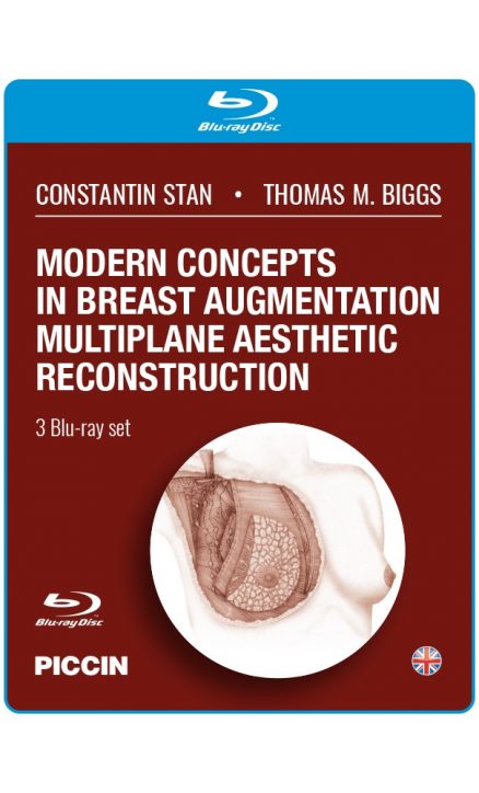MODERN CONCEPTS IN BREAST AUGMENTATION MULTIPLANE AESTHETIC RECONSTRUCTION