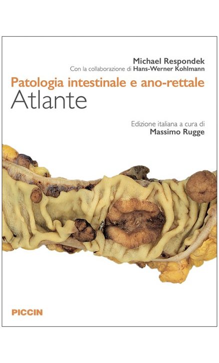 Patologia intestinale e ano-rettale - Atlante