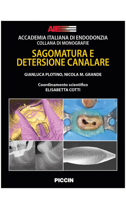 Sagomatura e Detersione Canalare