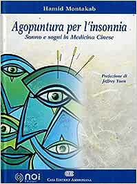 Agopuntura per l'insonnia