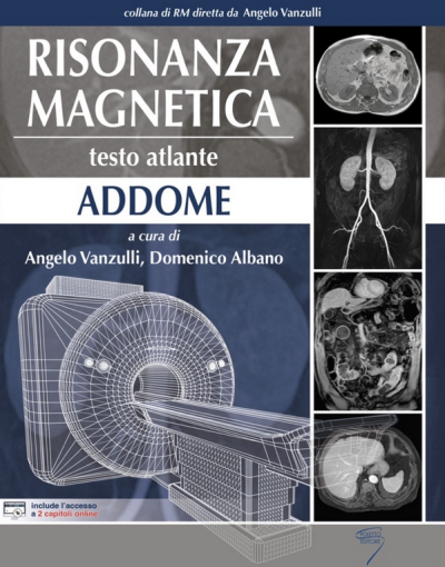 Risonanza Magnetica - Addome - Vanzulli - Albano