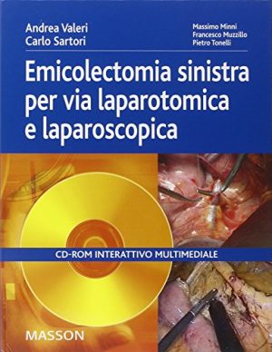Emicolectomia sinistra per via laparotomica e laparoscopica. CD-ROM