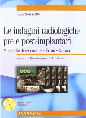 Le indagini radiologiche pre e post-implantari. Metodiche di esecuzione. Errori. Lettura