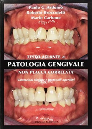 Testo atlante di patologia gengivale non placca correlata
