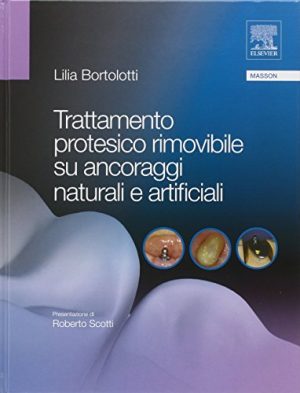 Trattamento protesico rimovibile su ancoraggi naturali e artificiali
