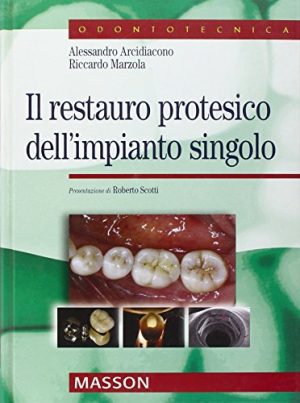 Il restauro protesico dell'impianto singolo