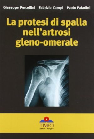 La protesi di spalla nell'artrosi gleno-omerale
