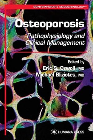 Osteoporosis: Pathophysiology and Clinical Management
