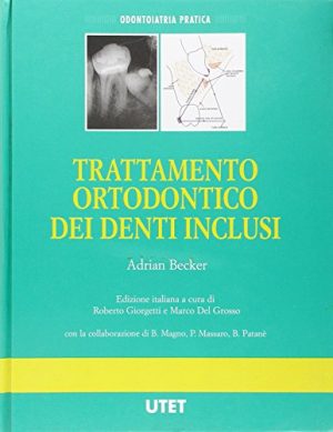 Trattamento ortodontico dei denti inclusi. Con videocassetta