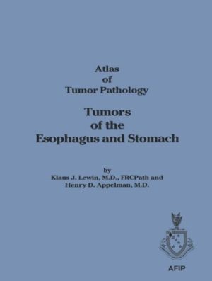 Tumors of the Esophagus & Stomach: 18