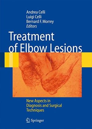 Treatment of Elbow Lesions: New Aspects in Diagnosis and Surgical Techniques [Lingua inglese]