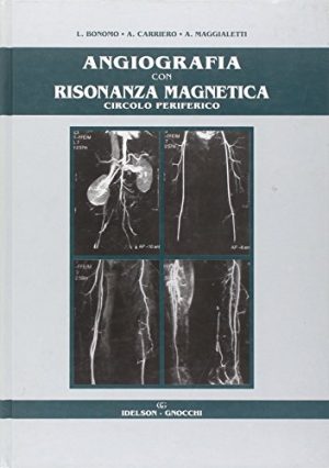 Angiografia con risonanza magnetica circolo periferico