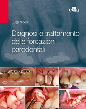 Diagnosi e trattamento delle forcazioni parodontali