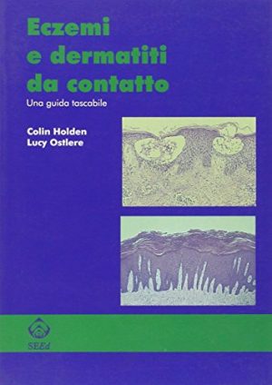 Eczemi e dermatiti da contatto