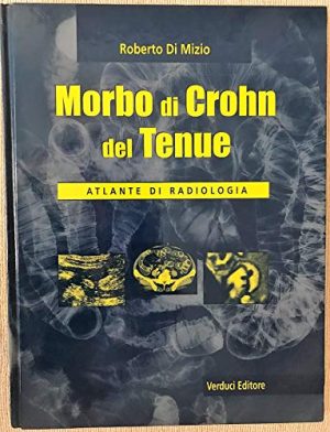 Morbo di Chron nel tenue. Atlante di radiologia
