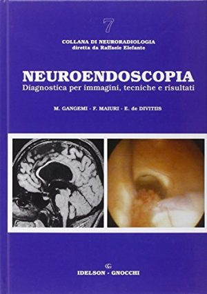 Neuroendoscopia. Diagnostica per immagini, tecniche e risultati