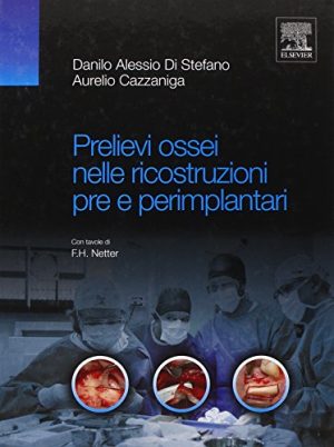 Prelievi ossei nelle ricostruzioni pre e perimplantari
