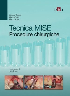 Tecnica MISE. Procedure chirurgiche