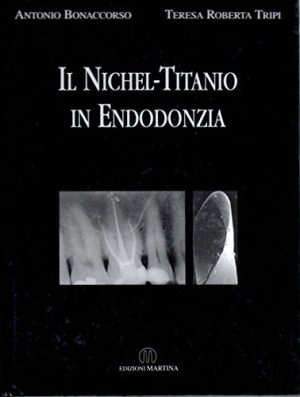 Il nichel-titanio in endodonzia