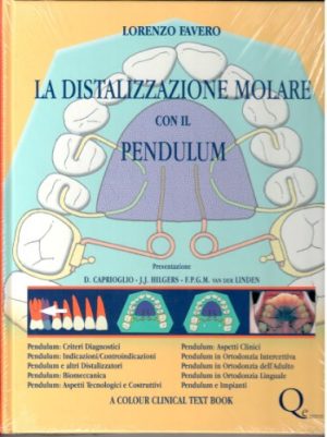 La distalizzazione molare con il pendulum