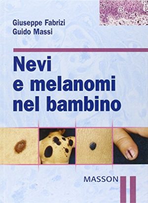 Nevi e melanomi nel bambino