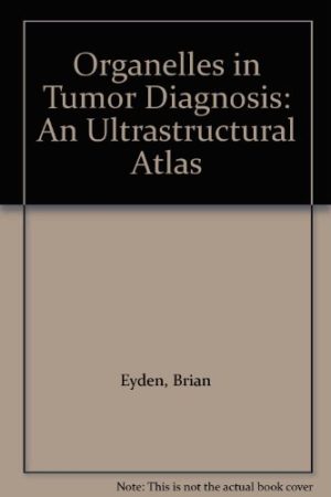 Organelles in Tumor Diagnosis: An Ultrastructural Atlas