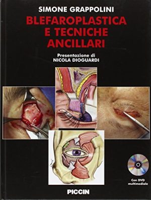 Blefaroplastica e Tecniche Ancillari + DVD