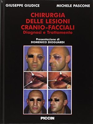 Chirurgia delle lesioni cranio-facciali Diagnosi e Trattamento