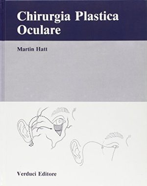 Chirurgia plastica oculare