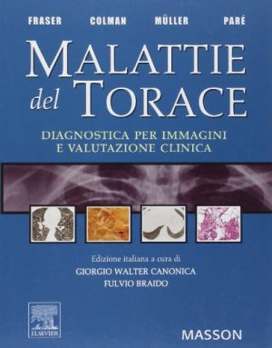 Malattie del torace. Diagnostica per immagini e valutazione clinica