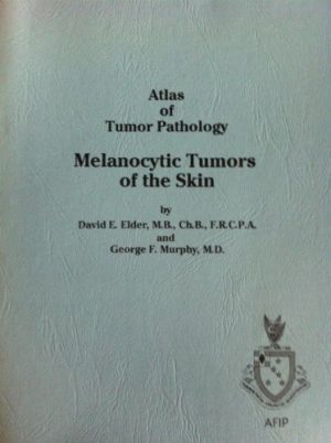 Melanocytic Tumors of the Skin