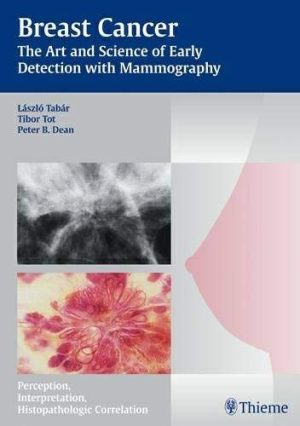 Brest Cancer: The Art and Sience of Early Detection with Mammography
