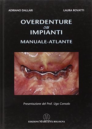 Overdenture su impianti. Manuale atlante
