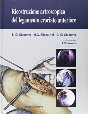 Ricostruzione artroscopica del legamento crociato