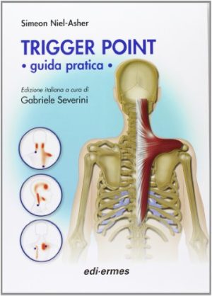 Trigger point