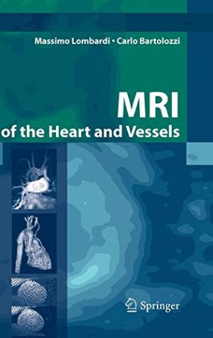 MRI of the heart and vessels