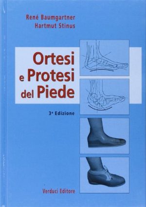 Ortesi e protesi del piede