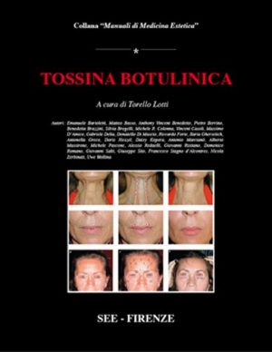 Tossina Botulinica