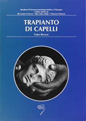 Trapianto di capelli