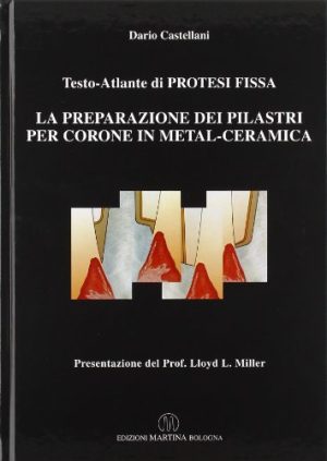 Atlante di protesi fissa. Per corone e ponti in metal-ceramica