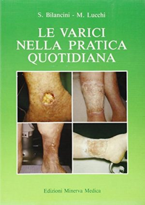 Le varici nella pratica quotidiana
